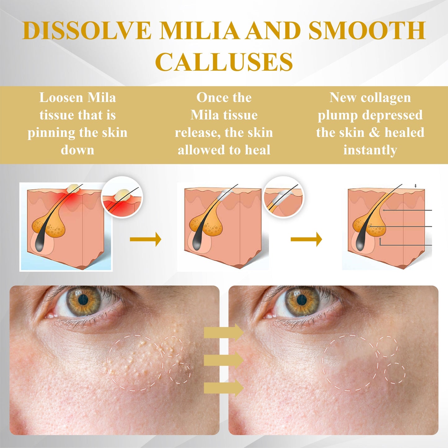 ATTDX® ApisCare Blemish & Tag Remover Stick
