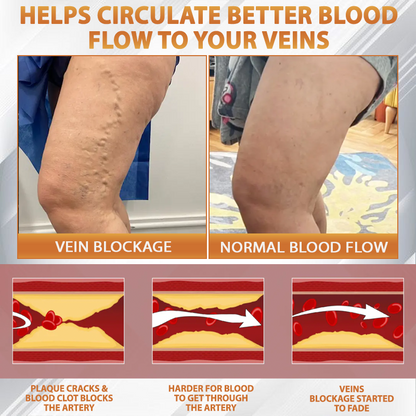 ATTDX® MicroSting Bee Vein Ease Patches