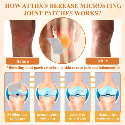 ATTDX® BeeEase MicroSting Joint Patches