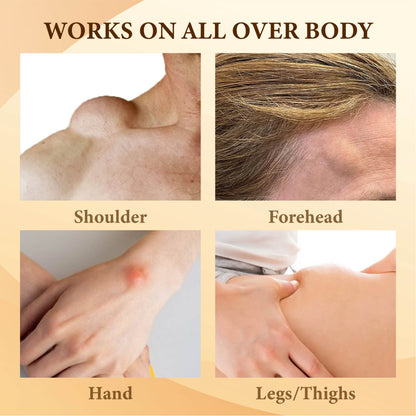 Bee Venom FatLumps LymphaticRecovery Cream