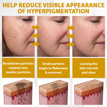 ATTDX® CastorBee Tag & Spots Peel-Off Mask
