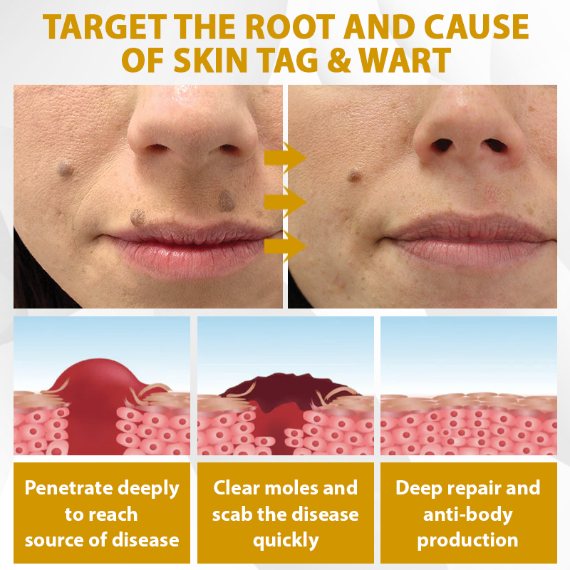 ATTDX® CastorBee Tag & Spots Peel-Off Mask