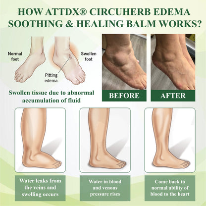 ATTDX® CircuHerb Edema Soothing & Healing Balm 2