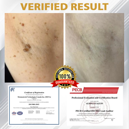 ATTDX® ClariBee Spot & Mole Corrective Cream