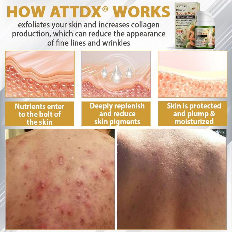 ATTDX® ClariBee Spot & Mole Corrective Cream