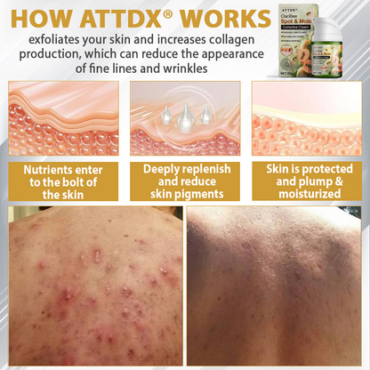 ATTDX® ClariBee Spot & Mole Corrective Cream