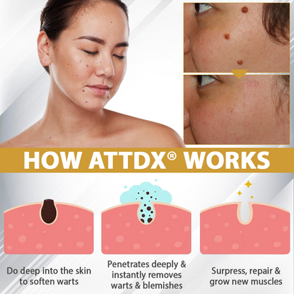 ATTDX® ClariBee Spot & Mole Corrective Cream