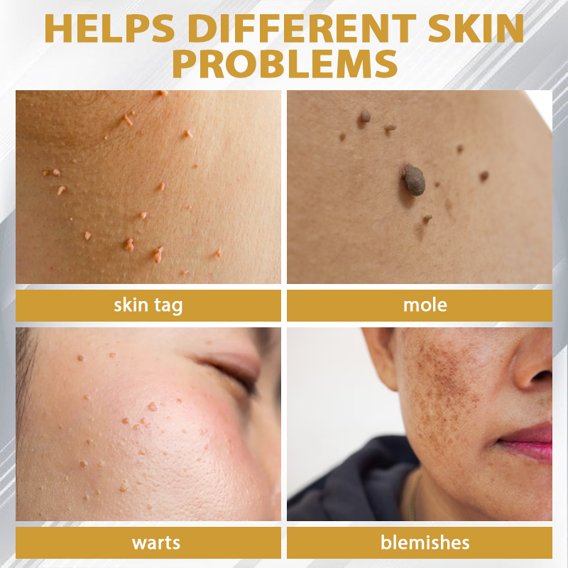 ATTDX® ClariBee Spot & Mole Corrective Cream