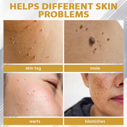 ATTDX® ClariBee Spot & Mole Corrective Cream