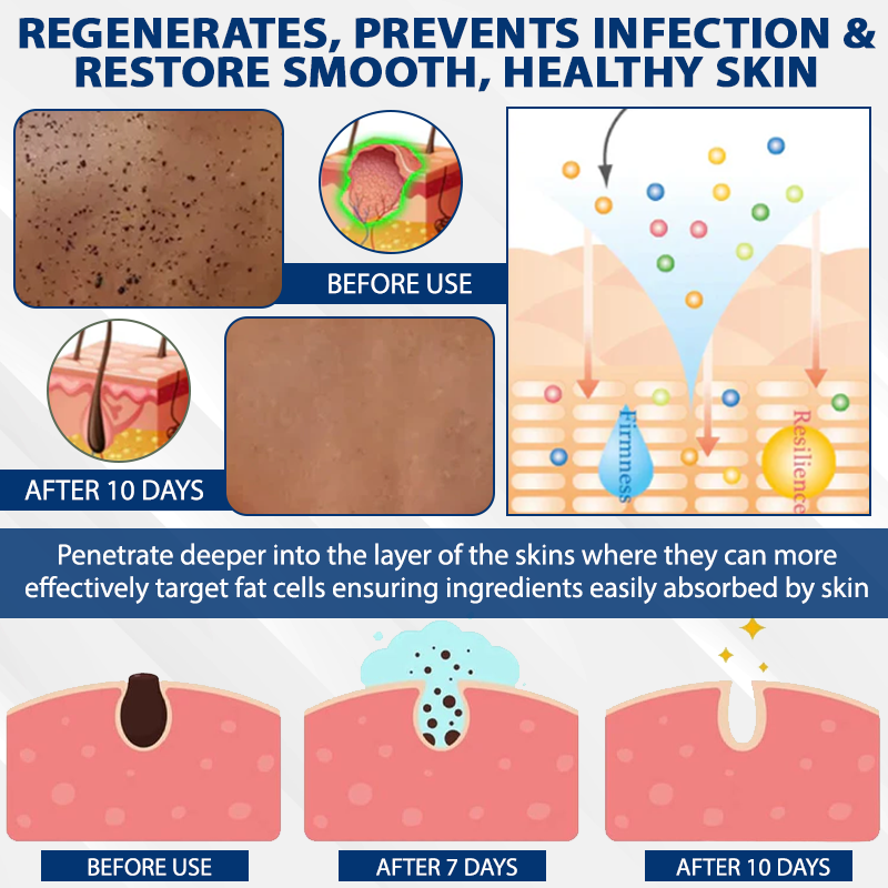 ATTDX® DermaSoft Tag & Mole Clear Gel