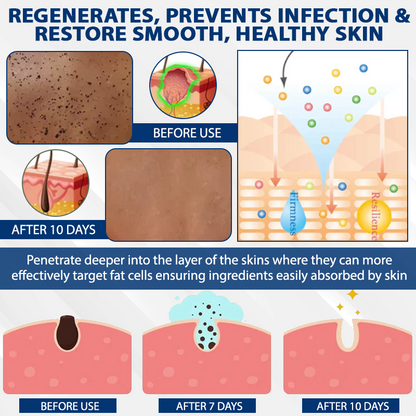 ATTDX® DermaSoft Tag & Mole Clear Gel