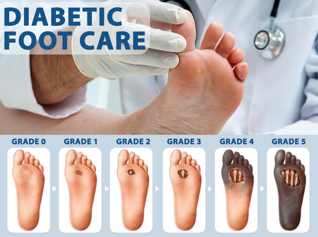 ATTDX® Diabetes Foot Guard Fast Recovery Spray