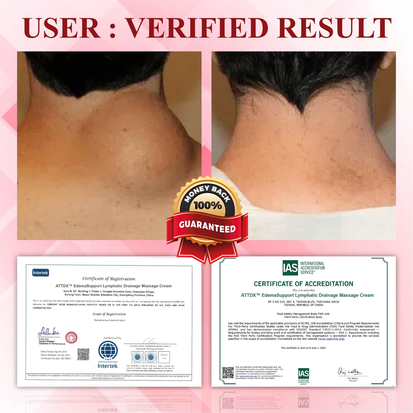 ATTDX® EdemaCare Lymphatic Drainage Massage Cream  -👩‍⚕️Doctor-Endorsed Herbal Formula