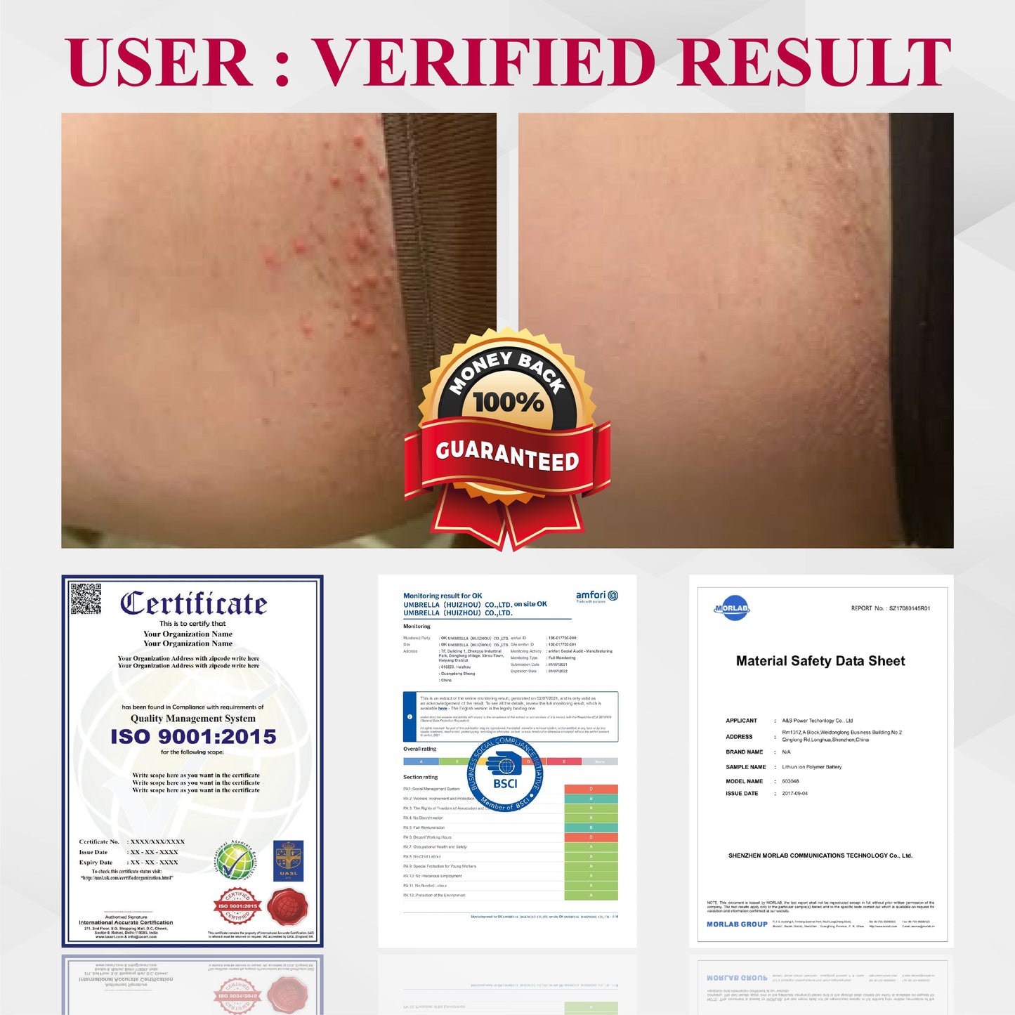 ATTDX® EndoLynx VulvaCare HPV Defense Cream
