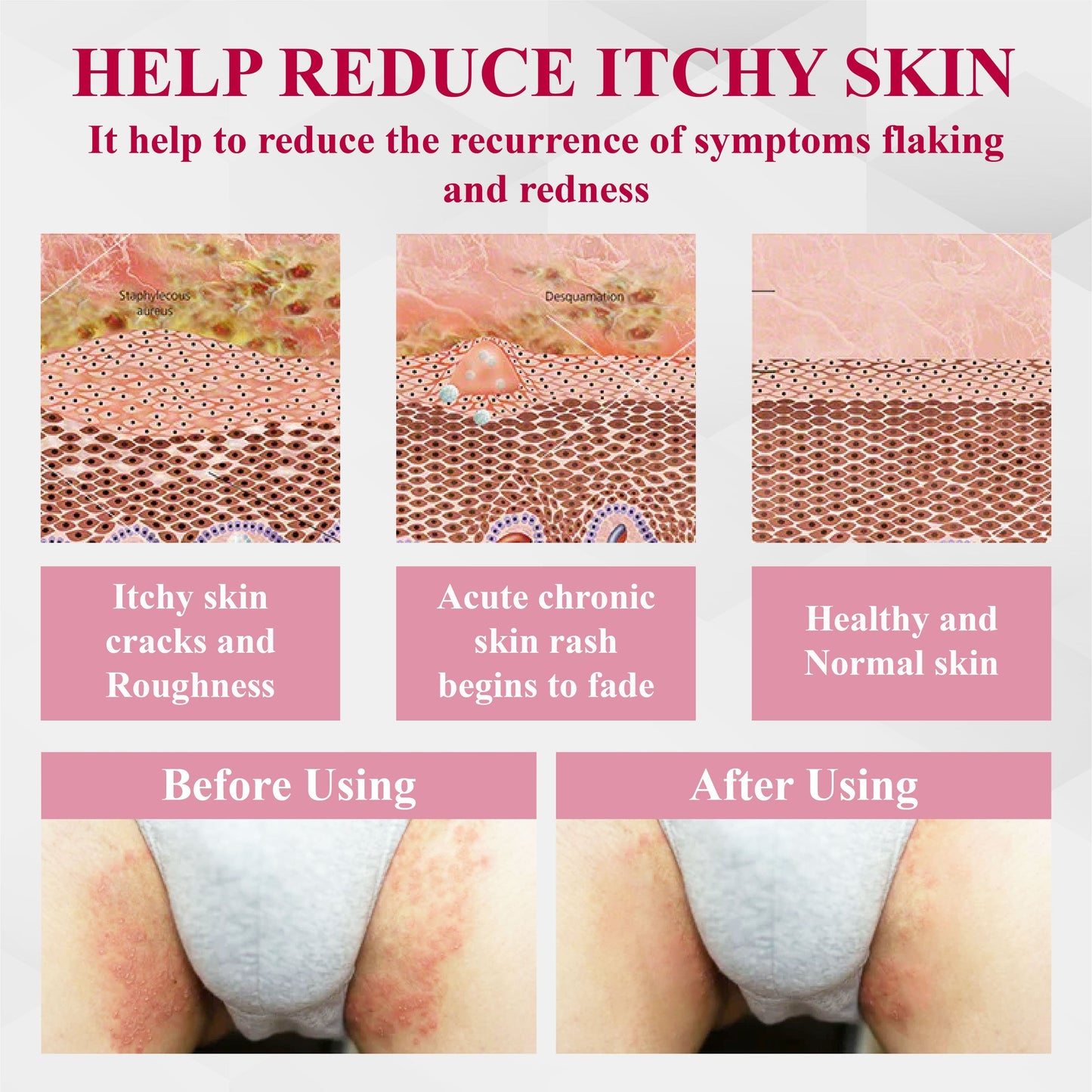 ATTDX® EndoLynx VulvaCare HPV Defense Cream