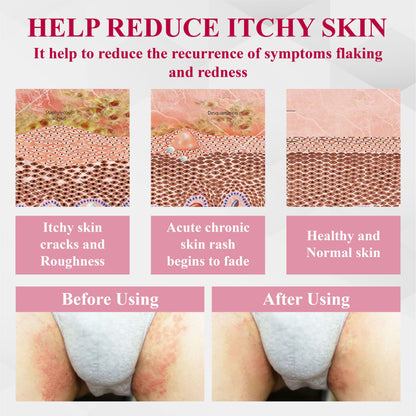 ATTDX® EndoLynx VulvaCare HPV Defense Cream