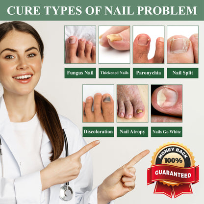 ATTDX® FungaGuard Nail Renewal Herbal Spray
