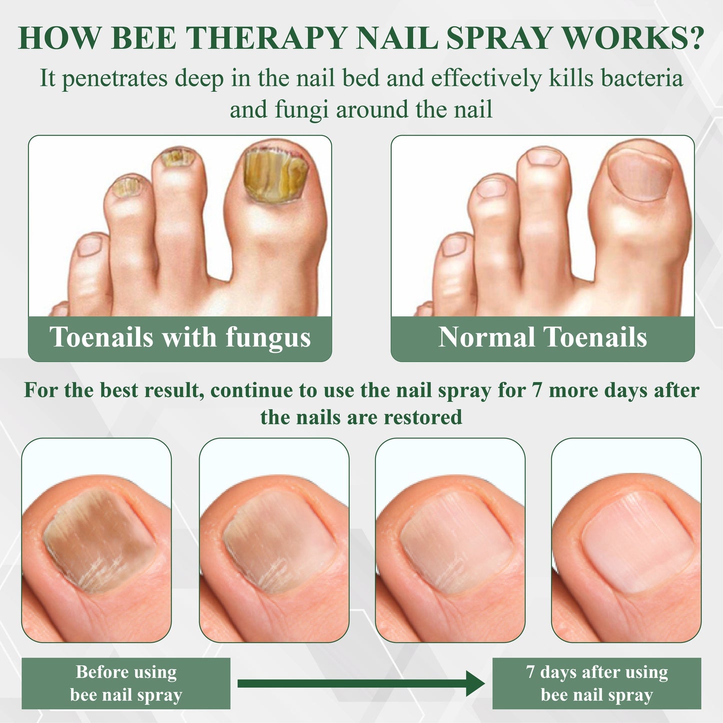 ATTDX® FungaGuard Nail Renewal Herbal Spray