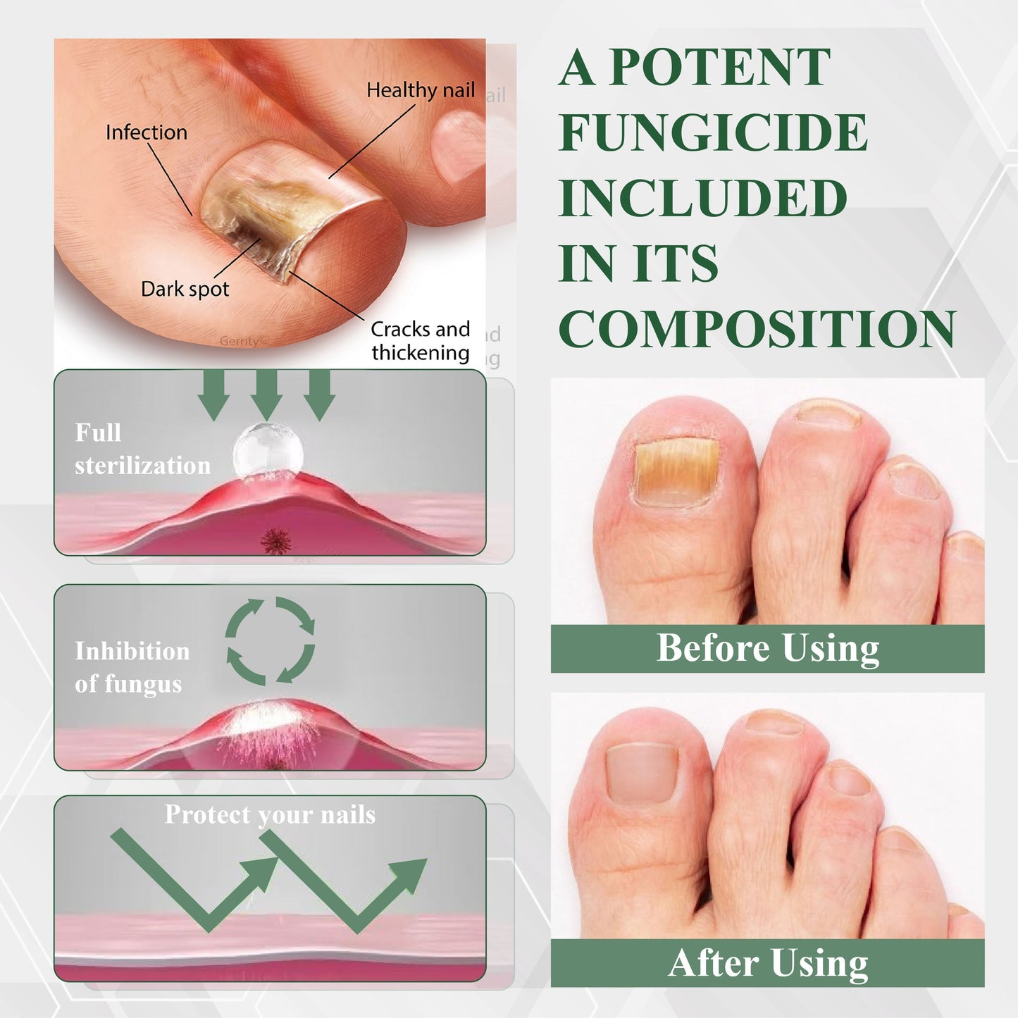 ATTDX® FungaGuard Nail Renewal Herbal Spray