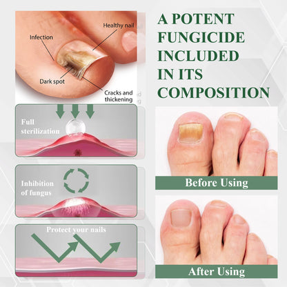ATTDX® FungaGuard Nail Renewal Herbal Spray