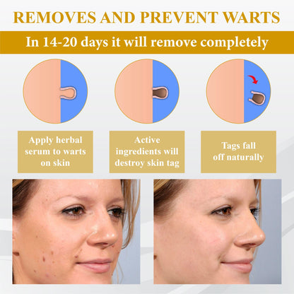 ATTDX® GoldenBee Tag & Blemish Repair Peel Gel Mask