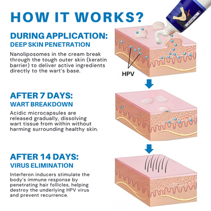 ATTDX® HPV Genital Warts Relief Cream