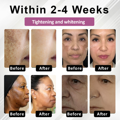ATTDX® Korean SkinRewind Spot & Wrinkles Toner Pads