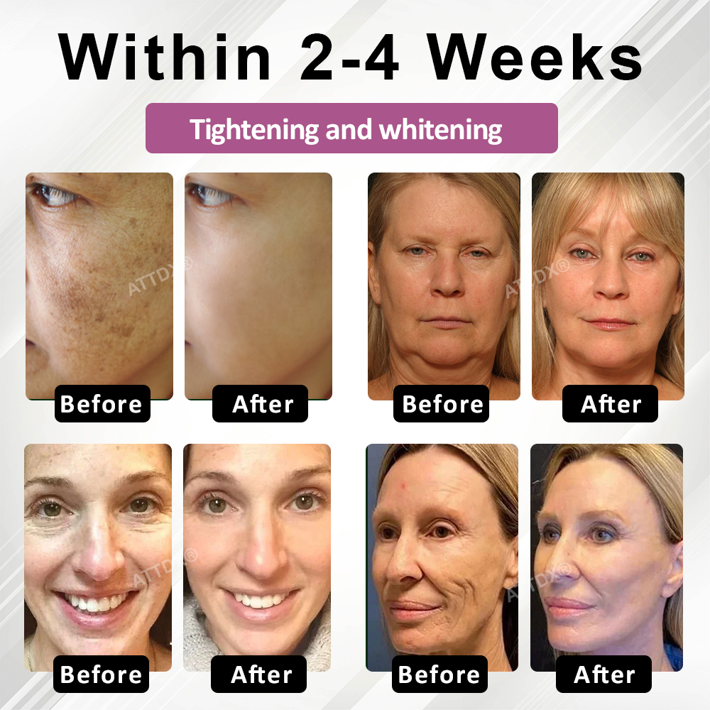 ATTDX® Korean SkinRewind Spot & Wrinkles Toner Pads