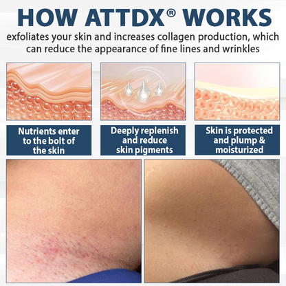 ATTDX® LicorRelief Man Genital Antifungal Cream