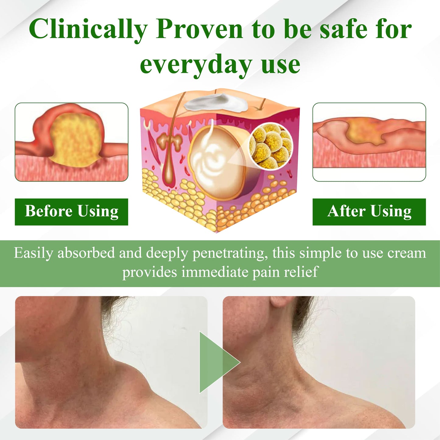 ATTDX® LipoClear Sparganium Rhizome Relief Cream