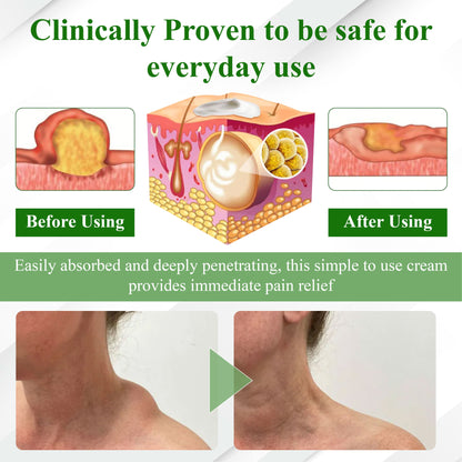 ATTDX® LipoClear Sparganium Rhizome Relief Cream