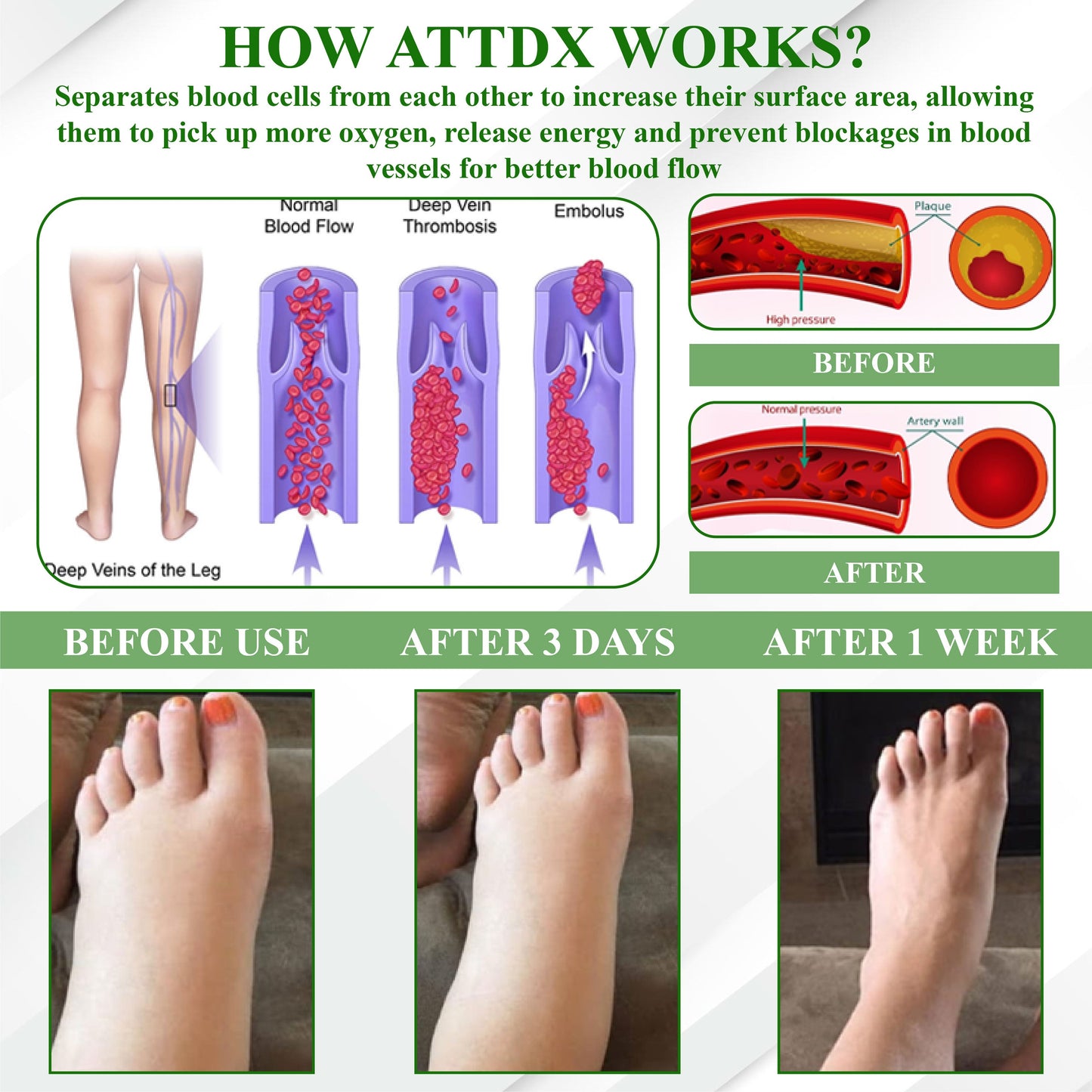 ATTDX® LipoClear Sparganium Rhizome Relief Cream