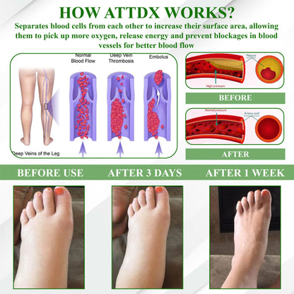 ATTDX® LipoClear Sparganium Rhizome Relief Cream