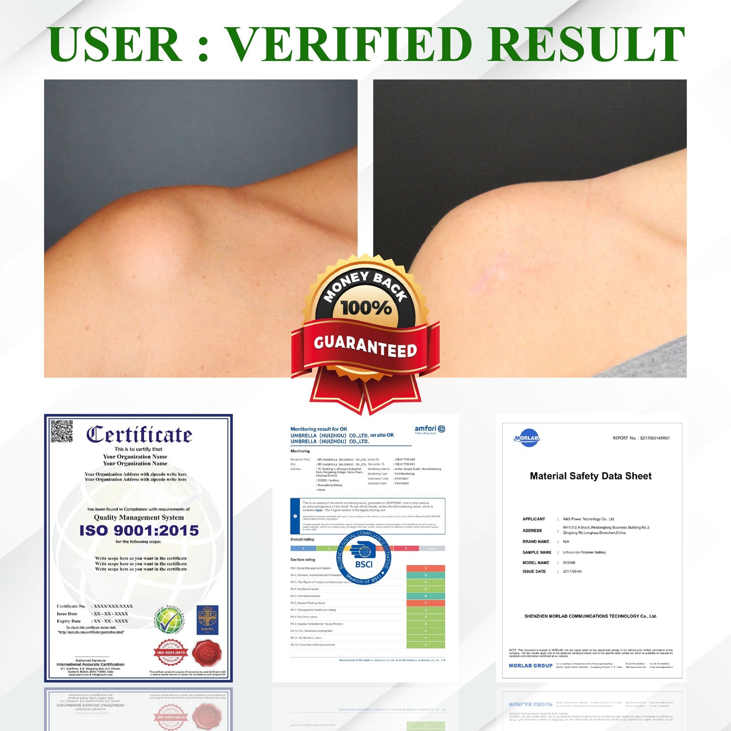 ATTDX® LipoClear Sparganium Rhizome Relief Cream