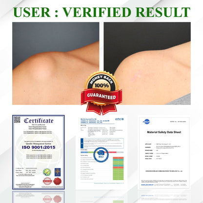 ATTDX® LipoClear Sparganium Rhizome Relief Cream