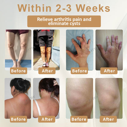 ATTDX® Emu Oil Turmeric Bone Sooth Gel 2