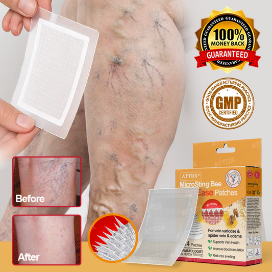 ATTDX® MicroSting Bee Vein Ease Patches