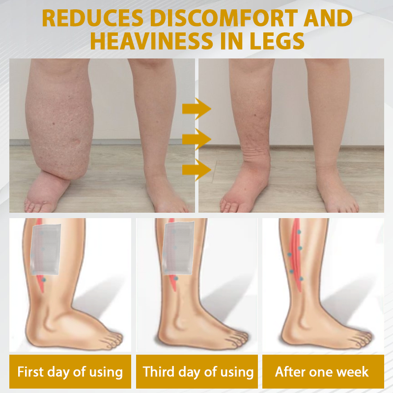 ATTDX® MicroSting Bee Vein Ease Patches