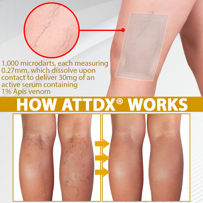 ATTDX® MicroSting Bee Vein Ease Patches