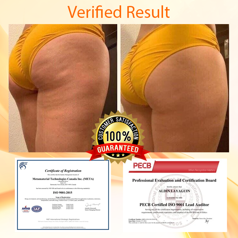 ATTDX™ Micro Crystals ButtLifting Patch