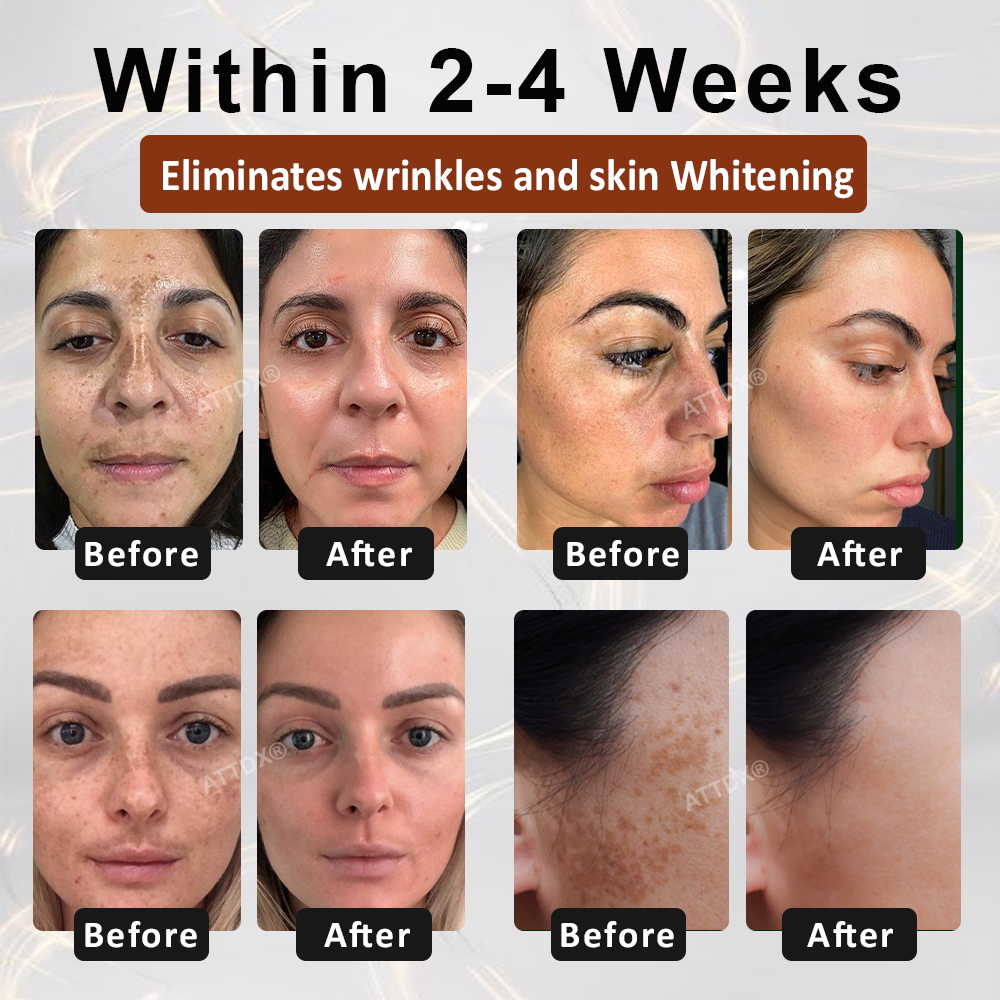 ATTDX® MulberryFade Spot & Wrinkles Peel-Off Mask