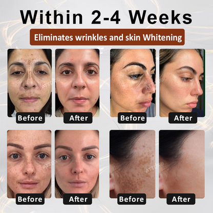 ATTDX® MulberryFade Spot & Wrinkles Peel-Off Mask