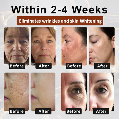 ATTDX® MulberryFade Spot & Wrinkles Peel-Off Mask