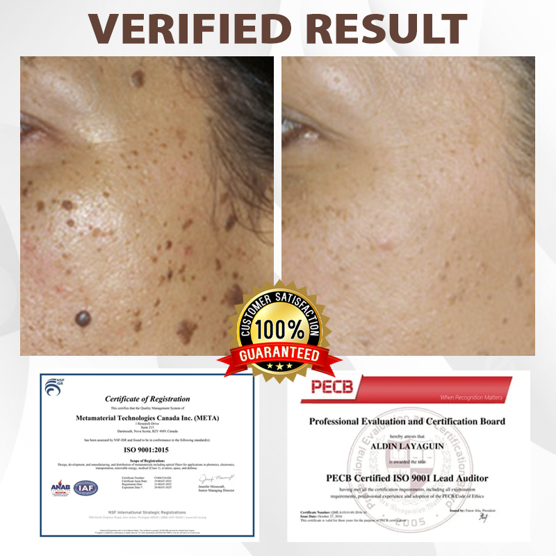 ATTDX® MulberryFade Spot & Wrinkles Peel-Off Mask