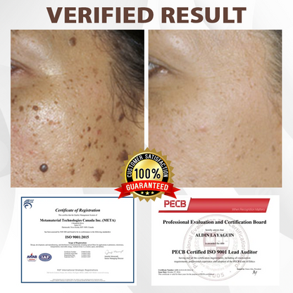 ATTDX® MulberryFade Spot & Wrinkles Peel-Off Mask