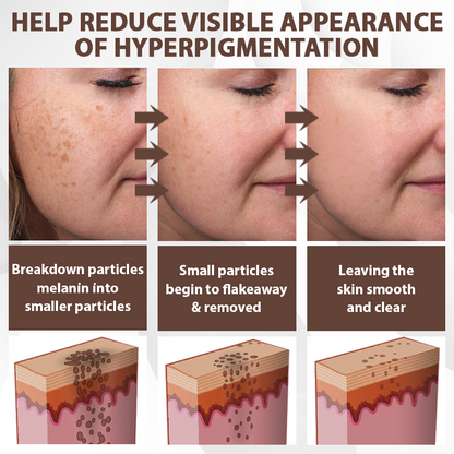 ATTDX® MulberryFade Spot & Wrinkles Peel-Off Mask