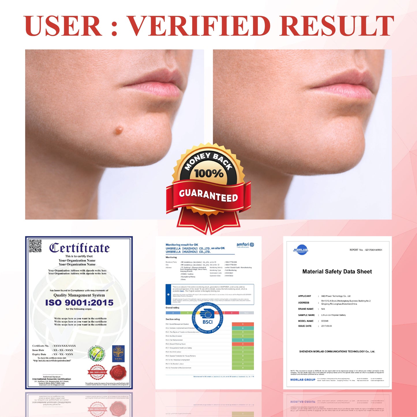 ATTDX® NanoDart Skin Tag Removal Patches