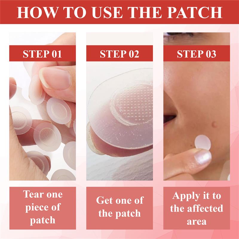 ATTDX® NanoDart Skin Tag Removal Patches