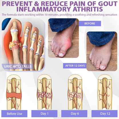ATTDX® Purple Corn Joint Targeted Relief Gel