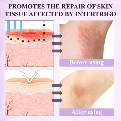 ATTDX® Purple Corn Multi-Condition Skin Spray